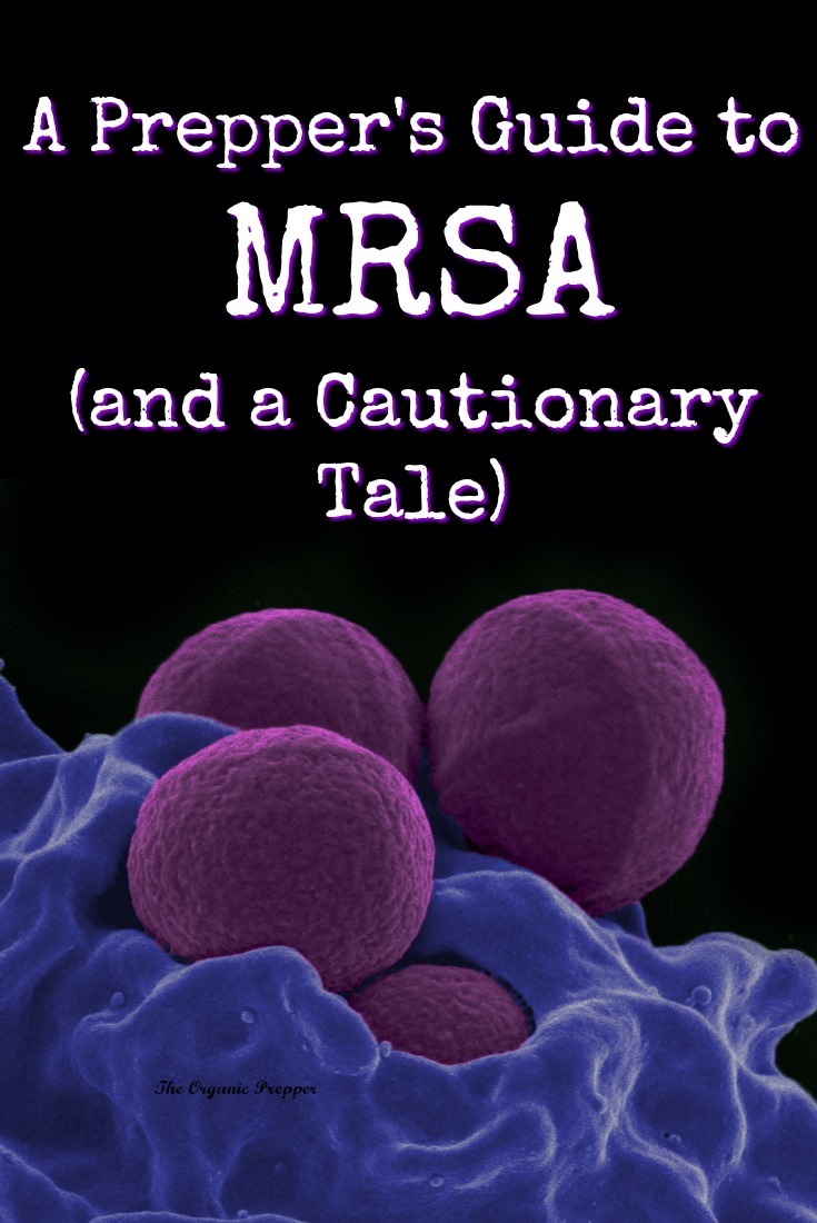 A Prepper\'s Guide to MRSA (and a Cautionary Tale)
